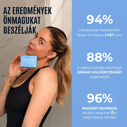 Hátpattanás Elleni Szappan